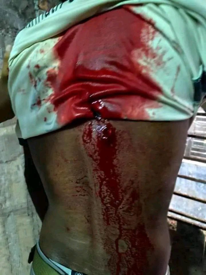 Memories of Wounded July