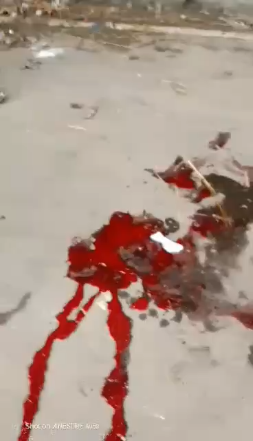 On the afternoon of August 5, a police officer shot Khokon directly in the face with a shotgun.