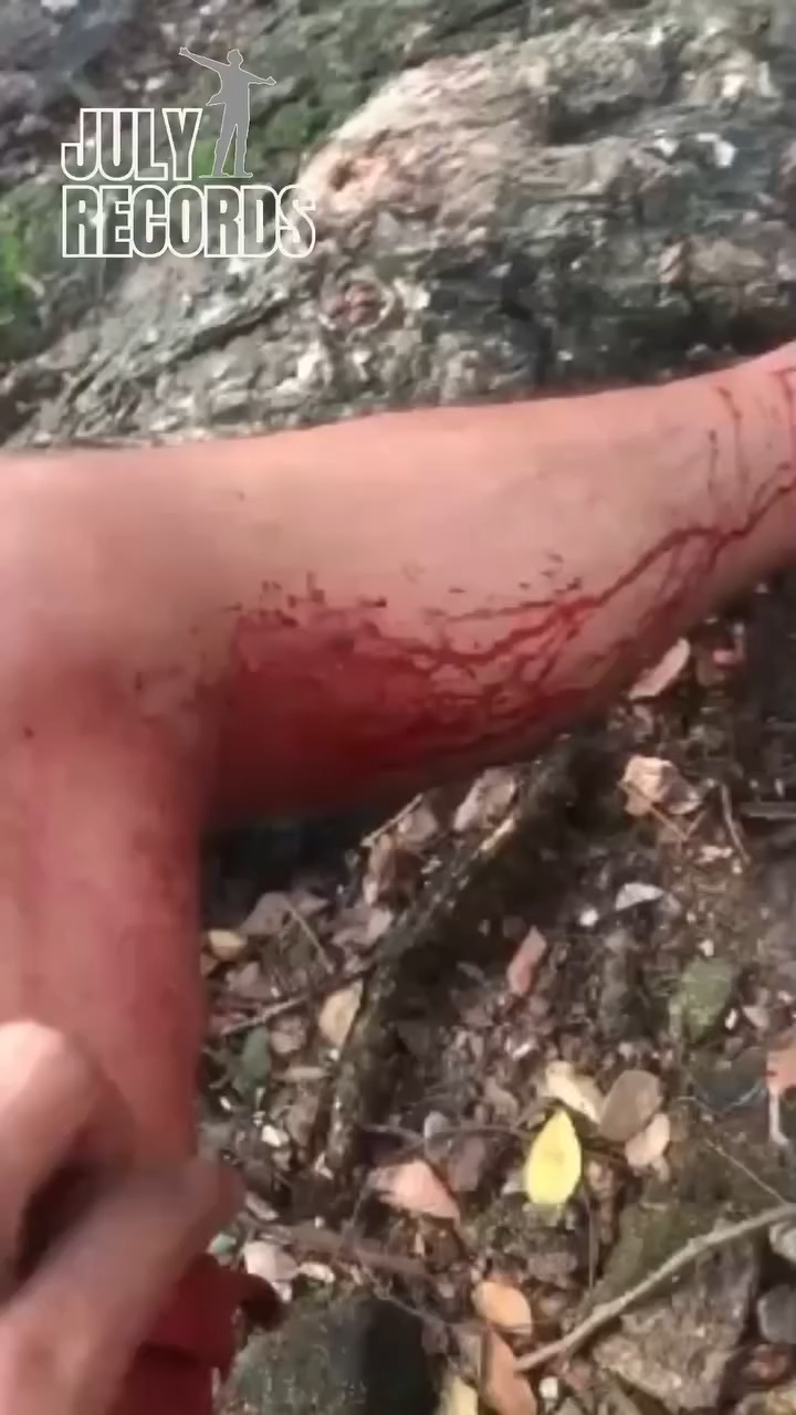 Video after Gazi Jewel Ahmed was injured in Chittagong Mansurabad!